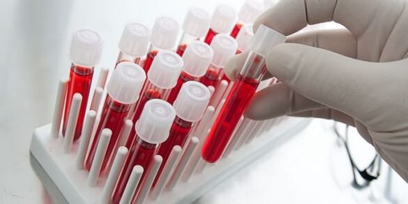krvni test